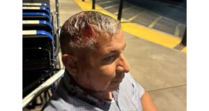 A kaliforniai ICE-tüntetéseken „kevésbé halálos” lövéssel fejbe lőtt férfit túlzott erőszak áldozatává vált – a kereset szerint – The Mercury News| mobilit.hu