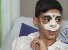 Az iráni gyermekosztályon belül: Az amerikai-izraeli légicsapások fájdalmas emberi költsége a világban Hírek| mobilit.hu